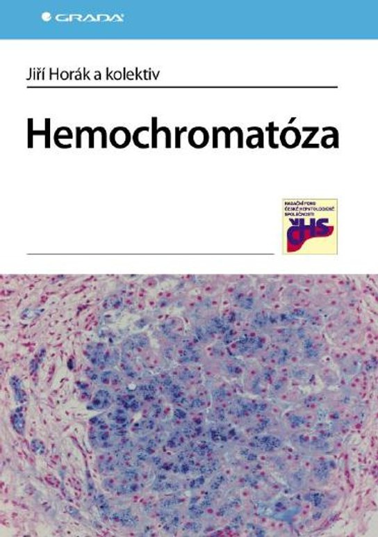 E-kniha: Hemochromatóza od Horák Jiří