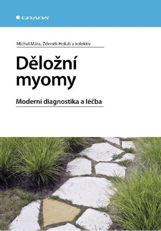 E-kniha: Děložní myomy od Mára Michal