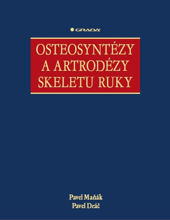 Osteosyntézy a artrodézy skeletu ruky -  Pavel Maňák