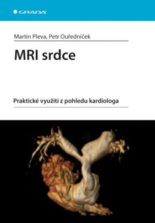 MRI srdce -  Petr Ouředníček