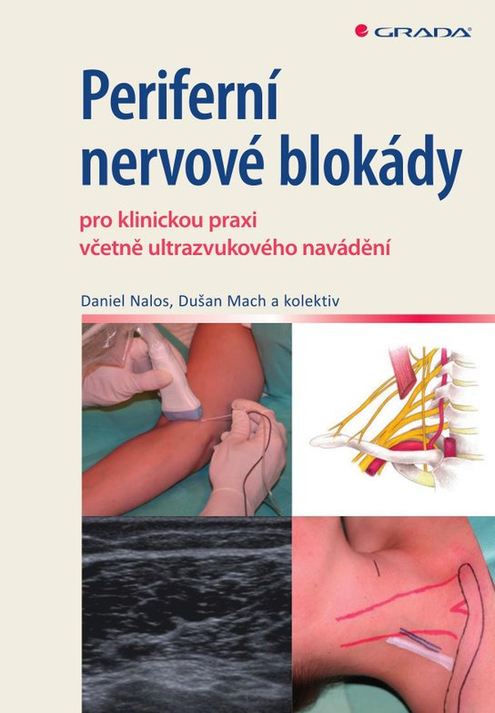 E-kniha: Periferní nervové blokády od Nalos Daniel
