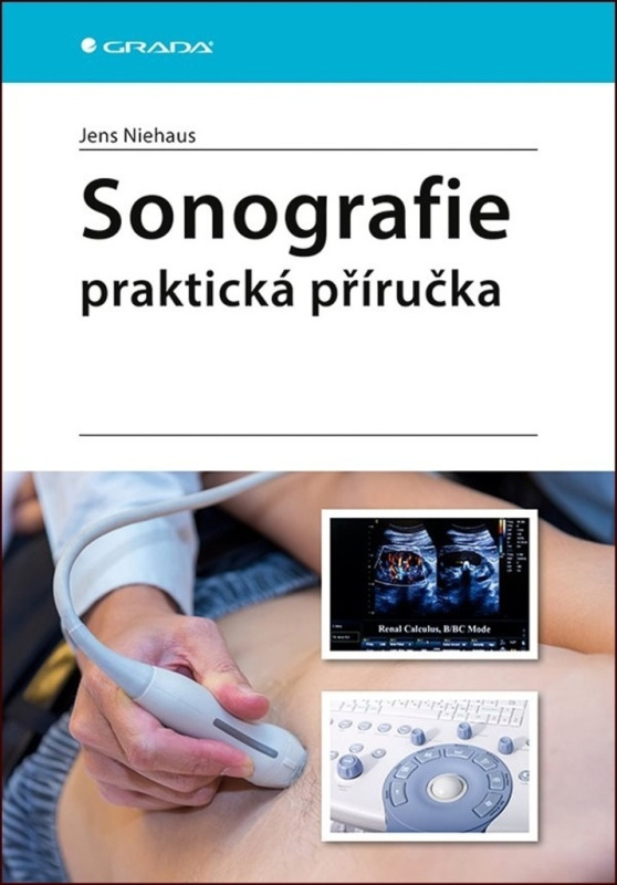 Sonografie - praktická příručka - Jens Niehaus