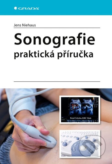 Sonografie - praktická příručka - Jens Niehaus