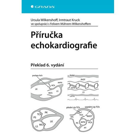 Příručka echokardiografie - Irmtraut Kruck, Ursula Wilkenshoff