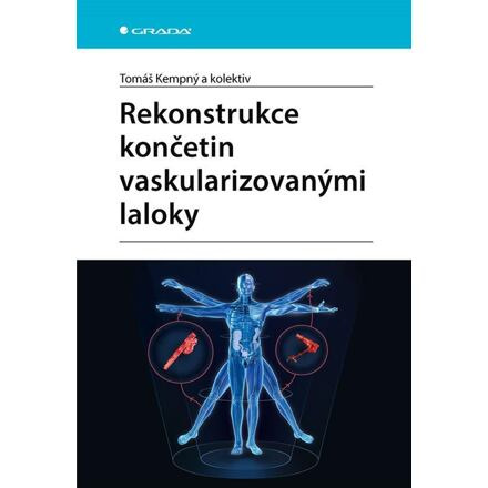 Rekonstrukce končetin vaskularizovanými laloky - Tomáš Kempný, kol.