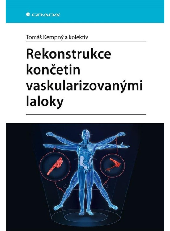 Rekonstrukce končetin vaskularizovanými laloky - Tomáš Kempný, kol.