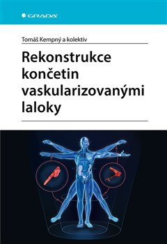 Rekonstrukce končetin vaskularizovanými laloky - Tomáš Kempný, kol.
