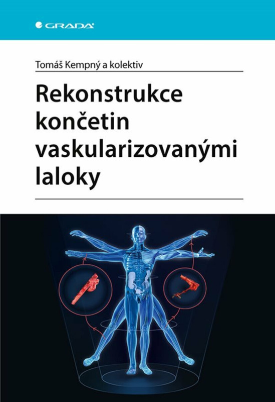 Rekonstrukce končetin vaskularizovanými laloky - Tomáš Kempný, kol.