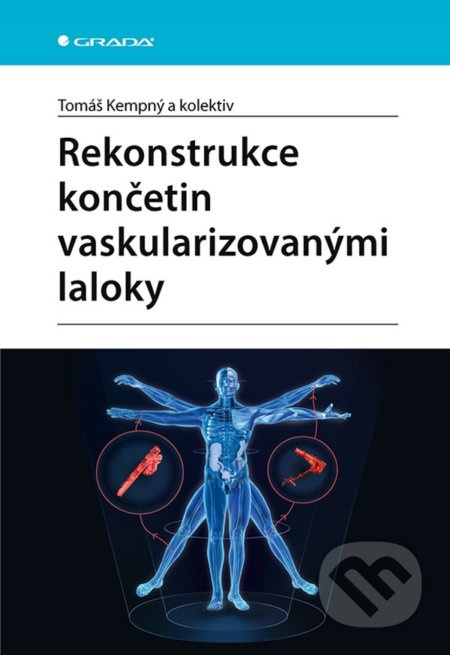 Rekonstrukce končetin vaskularizovanými laloky - Tomáš Kempný, kol.