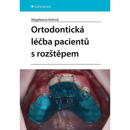 Ortodontická léčba pacientů s rozštěpem - Magdalena Koťová
