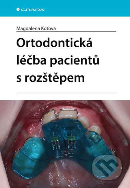Ortodontická léčba pacientů s rozštěpem - Magdalena Koťová