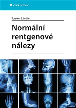 Normální rentgenové nálezy - Torsten B. Möller