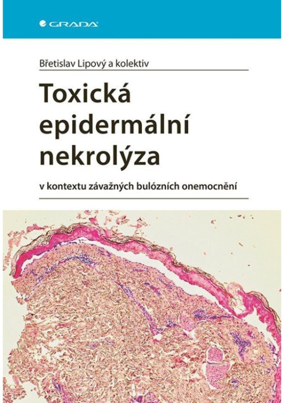 Toxická epidermální nekrolýza - Břetislav Lipový, kol.