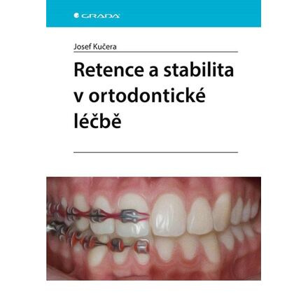 Retence a stabilita v ortodontické léčbě - Josef Kučera