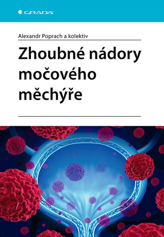 Zhoubné nádory močového měchýře -  Alexandr Poprach