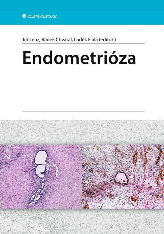 Endometrióza -  Jiří Lenz