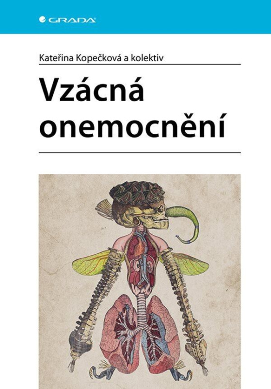 Vzácná onemocnění - Kateřina Kopečková, kolektiv