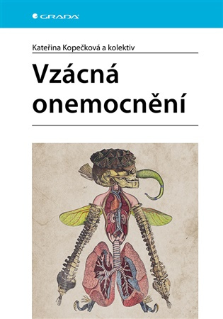 Vzácná onemocnění - Kateřina Kopečková, kolektiv