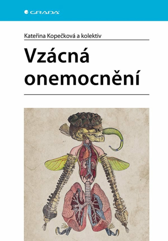Vzácná onemocnění - Kateřina Kopečková, kolektiv
