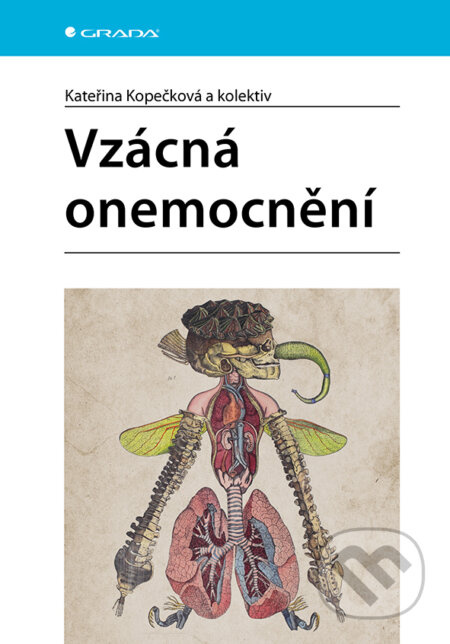 Vzácná onemocnění - Kateřina Kopečková, kolektiv