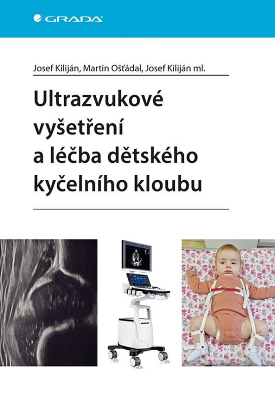 Kniha: Ultrazvukové vyšetření a léčba dětského kyčelního kloubu od Kiliján Josef