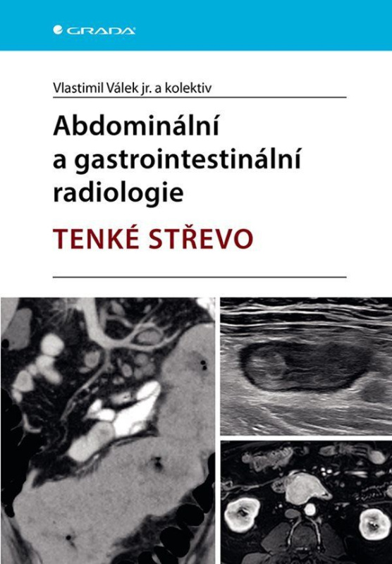 Abdominální a gastrointestinální radiologie (Tenké střevo) - kniha z kategorie Vysoké školy