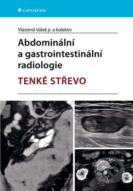 Abdominální a gastrointestinální radiologie (Tenké střevo) - kniha z kategorie Vysoké školy