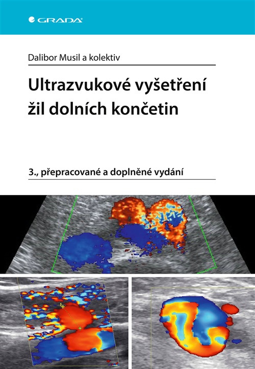 Ultrazvukové vyšetření žil dolních končetin
