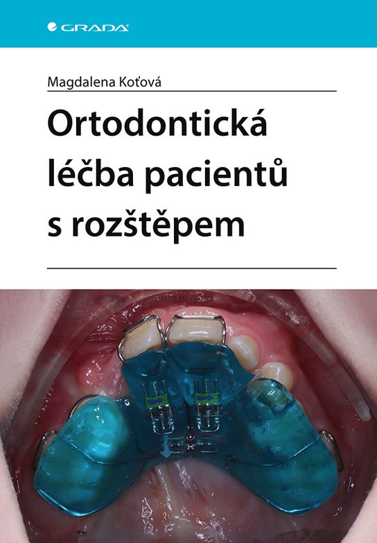 E-kniha: Ortodontická léčba pacientů s rozštěpem od Koťová Magdalena