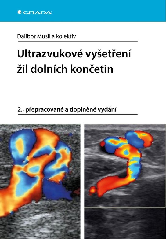 Ultrazvukové vyšetření žil dolních končetin -  kolektiv a