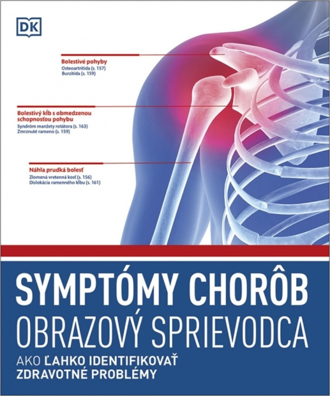 Symptómy chorôb (Obrazový sprievodca) - kniha z kategorie Zdraví a životní styl