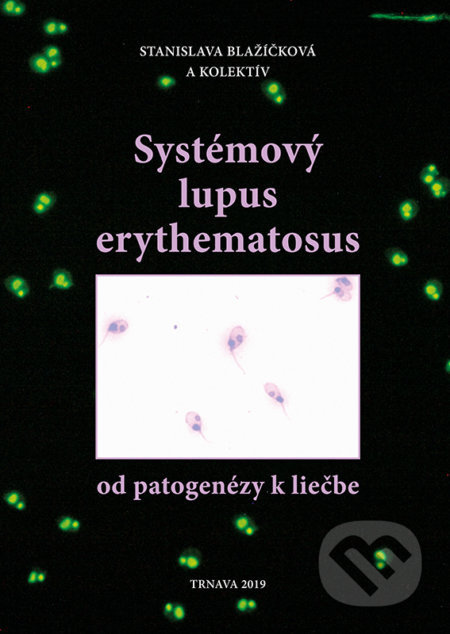 Systémový lupus erythematosus (od patogenézy k liečbe) - kniha z kategorie Medicína