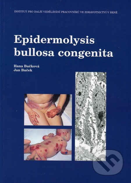 Epidermolysis bullosa congenita - Hana Bučková, Jan Buček - kniha z kategorie Dermatologie