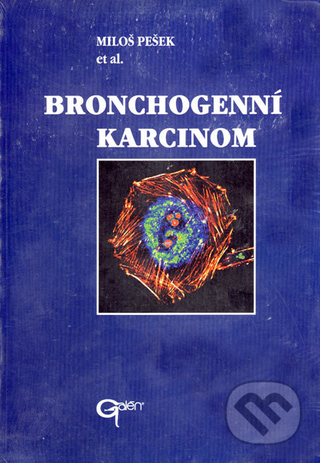 Bronchogenní karcinom - Miloš Pešek - kniha z kategorie Onkologie
