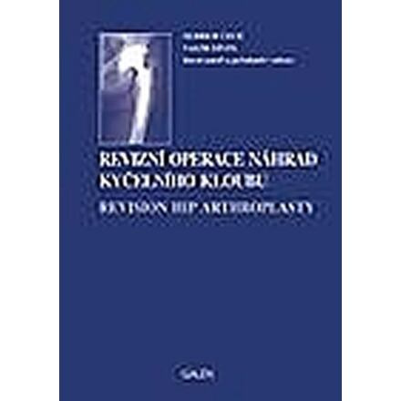 Revizní operace náhrad kyčelního kloubu
