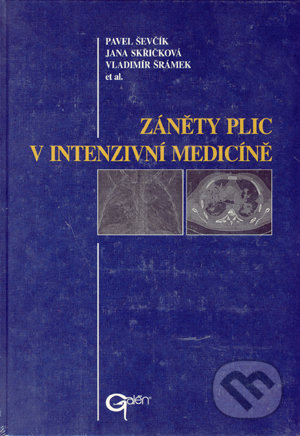 Záněty plic v intenzivní medicíně - Pavel Ševčík, Jana Skřičková, Vladimír Šrámek a kolektív - kniha z kategorie Medicína