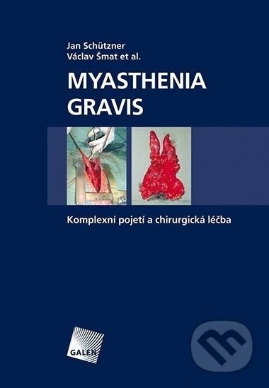 Myasthenia gravis (Komplexní pojetí a chirurgická léčba) - kniha z kategorie Všeobecná chirurgie