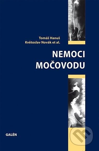 Nemoci močovodu - Tomáš Hanuš - kniha z kategorie Urologie
