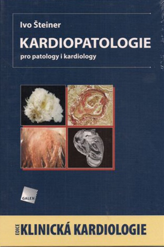 Kardiopatologie pro patology i kardiology - Ivo Šteiner - kniha z kategorie Kardiologie a angiologie