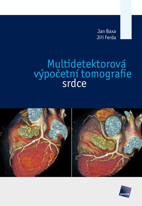 Multidetektorová výpočetní tomografie srdce - Jan Baxa, Jiří Ferda