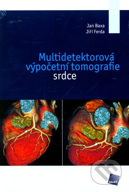 Multidetektorová výpočetní tomografie srdce - Jan Baxa, Jiří Ferda
