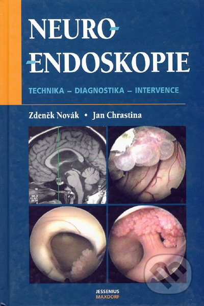 Neuroendoskopie - Zdeněk Novák, Jan Chrastina - kniha z kategorie Neurochirurgie