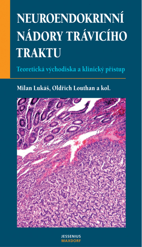 Neuroendokrinní nádory trávicího traktu (Teoretická východiska a klinický přístup) - kniha z kategorie Endokrinologie