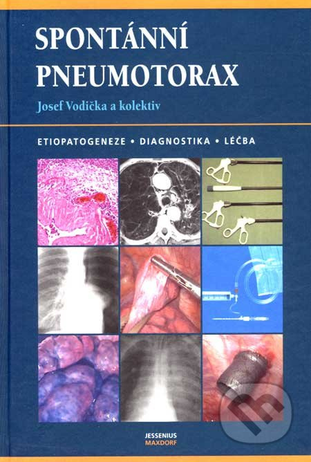 Spontánní pneumotorax (Etiopatogeneze - Diagnostika - Léčba) - kniha z kategorie Pneumologie