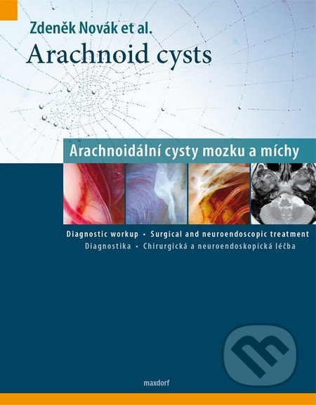 Arachnoid cysts (Arachnoidální cysty mozku a míchy) - kniha z kategorie Neurologie