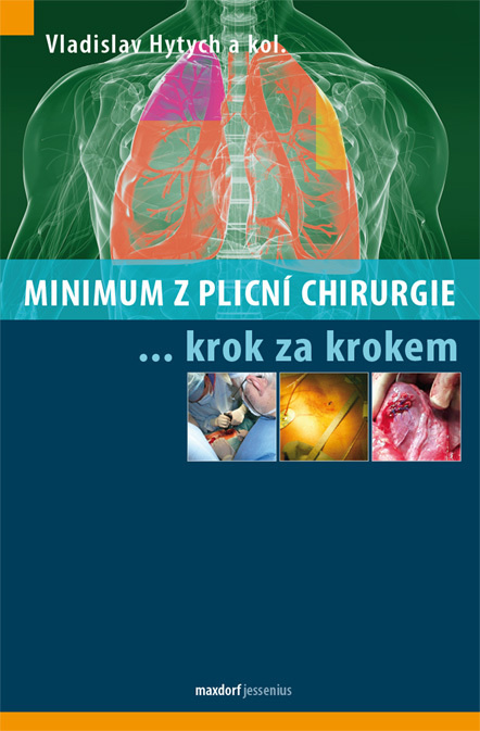 Minimum z plicní chirurgie krok za krokem - kol., Vladislav Hytych
