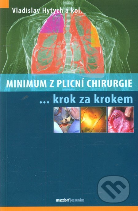 Minimum z plicní chirurgie krok za krokem - kol., Vladislav Hytych