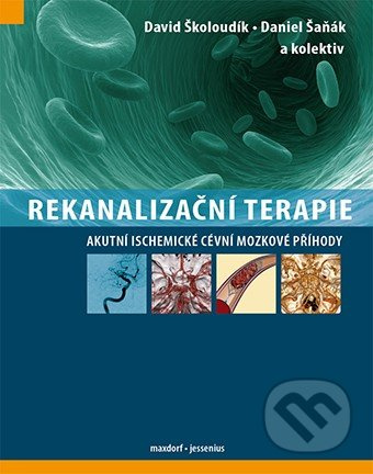 Rekanalizační terapie (Akutní ischemické cévní mozkové příhody) - kniha z kategorie Kardiovaskulární chirurgie