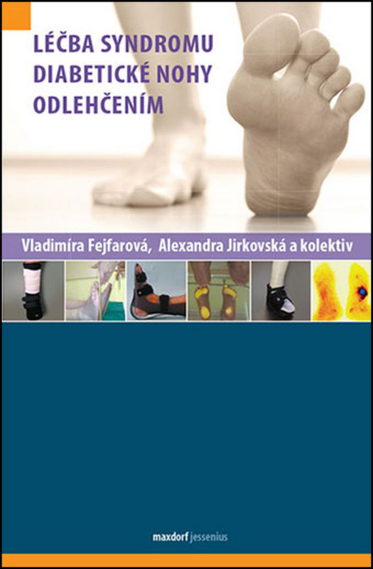 Léčba syndromu diabetické nohy odlehčením - Vladimíra Fejfarová, Alexandra Jirkovská, kol.