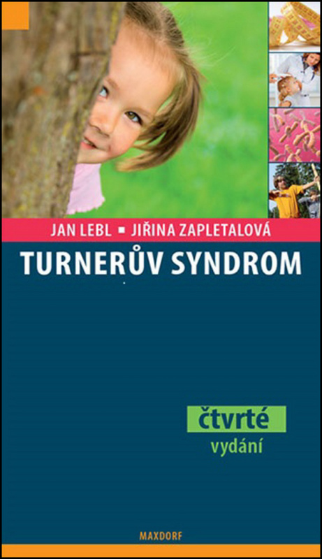 Turnerův syndrom (4. vydání) - Jan Lebl, Jiřina Zapletalová - kniha z kategorie Odborné a naučné